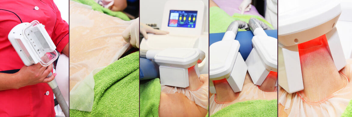 CoolSculpting vs. CoolTech: Comparing and Contrasting Two Fat-Freezing Procedures